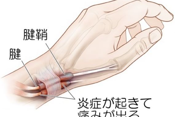 サンプル