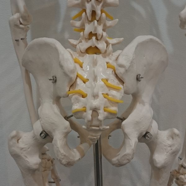 手術をしても治らない脊柱管狭窄症は仙腸のズレが原因